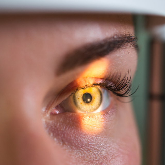 Vision Therapy in Monroeville